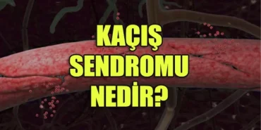 kacis-sendromu-nedir-belirtileri-nelerdir-nasil-tedavi-edilir-CP9hWJU5.jpg