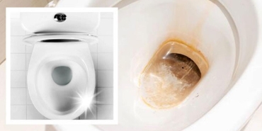 sadece-1-saat-icerisinde-tuvalet-kirecini-sokup-atin-tuvalet-kireci-nasil-temizlenir-X3R2h8Hk.jpg